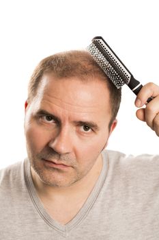 Baldness Alopecia man hair loss haircare medicine bald treatment transplantation