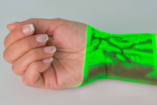 The venous drawing on a wrist of a female hand received by means of Vein Viever Vision