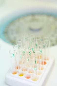 A pipette dropping sample into a test tube,abstract science background. Shallow dof