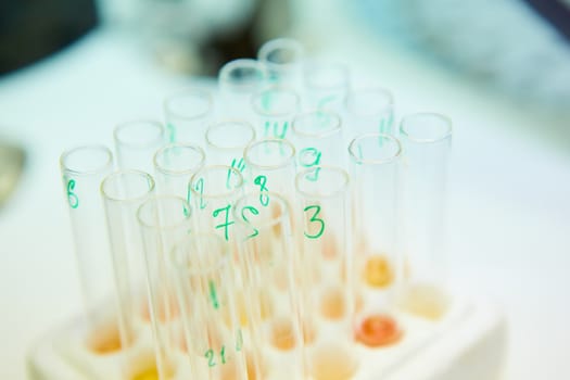 A pipette dropping sample into a test tube,abstract science background. Shallow dof