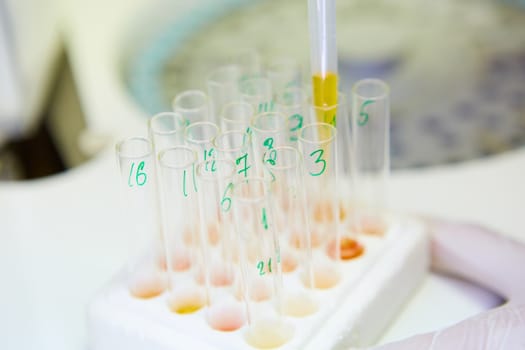 A pipette dropping sample into a test tube,abstract science background. Shallow dof