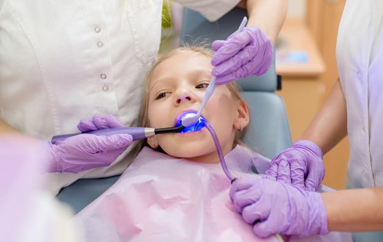 Beautiful little girl at visit in the dentist office. She is sitting on a chair and dentist finishing repair tooth with dental curing UV lamp. Selective focus.