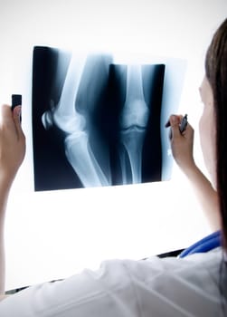 Doctor looking at the x-ray picture knee in hospital