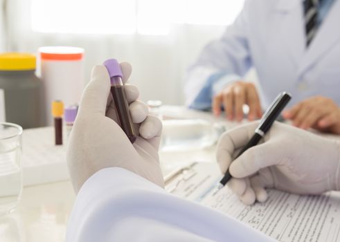 Doctor holding a bottle of blood sample in lab. science and medical concept