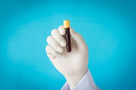 Hand with latex glove holding blood sample.