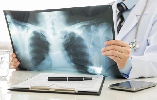 doctor holding x-ray or roentgen image in hospital