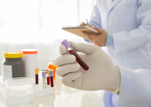 Doctor holding a bottle of blood sample in lab. science and medical concept
