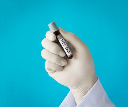 Hand with latex glove holding blood sample for hiv test.