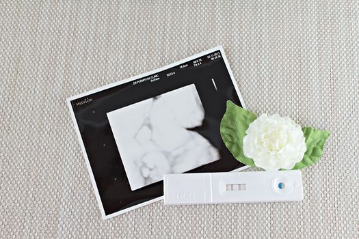 New born baby at ultrasound scan of baby, positive pregnancy test and white jasmine flower on tablecloth background