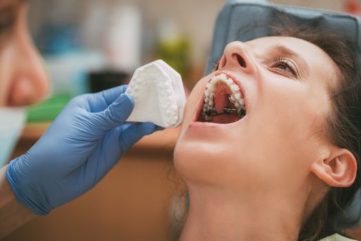 Dentist checking braces on the female patient. Close-up. Real People.