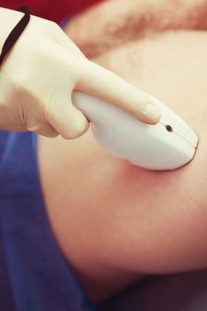 man receiving laser epilation at armpit on beauty center