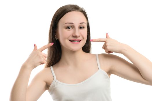 Closeup multicolored Braces on Teeth. Beautiful Female Smile portrait with Self-ligating Braces. Orthodontic Treatment.