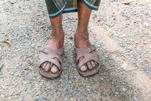 Gopalgonj, Bangladesh - September 19, 2016: Legs of a labor with muddy at Gopalgonj, Bangladesh