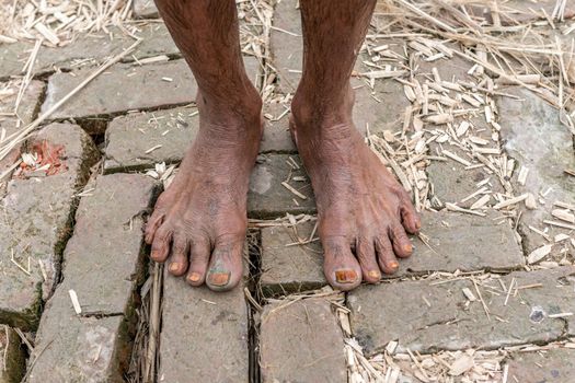 Gopalgonj, Bangladesh - September 20, 2016: Legs of a labor with muddy at Gopalgonj, Bangladesh