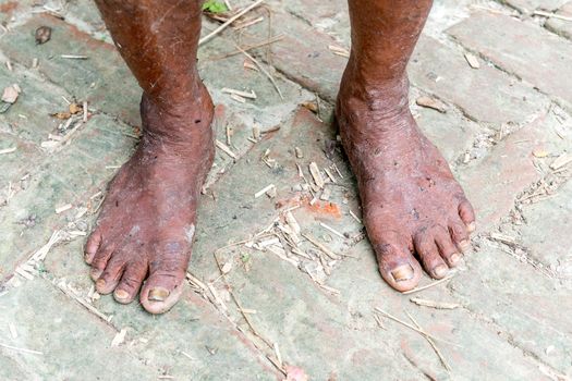 Gopalgonj, Bangladesh - September 20, 2016: Legs of a labor with muddy at Gopalgonj, Bangladesh