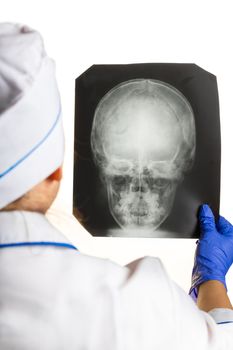 Doctor is looking X-ray of the head