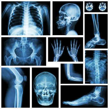 Set of x-ray multiple part of human . Skeletal system .