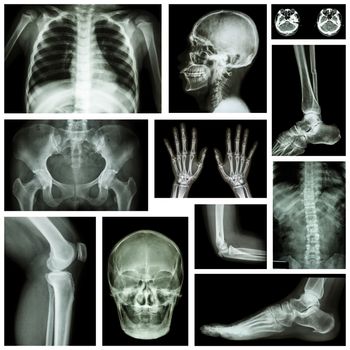 Set of x-ray multiple part of human . Skeletal system .