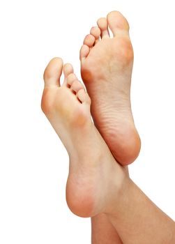 Female feet with calluses, isolated on white background