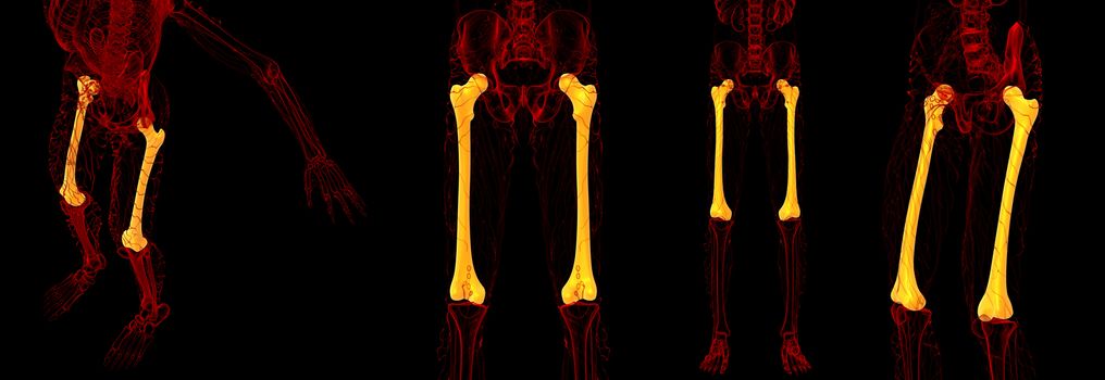 3d rendering medical illustration of the femur bone 