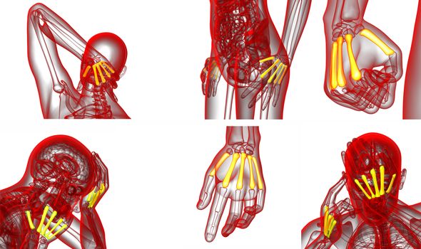 3d rendering medical illustration of the metacarpal bone 