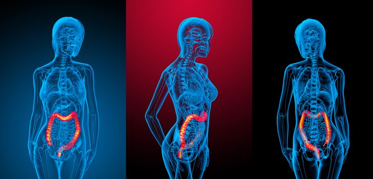 3d rendering medical illustration of the human larg intestine