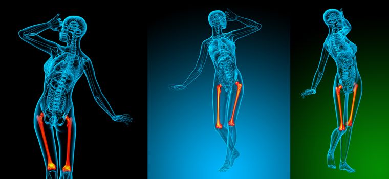 3d rendering medical illustration of the femur bone 