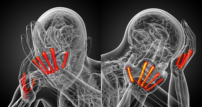 3d rendering medical illustration of the metacarpal bone