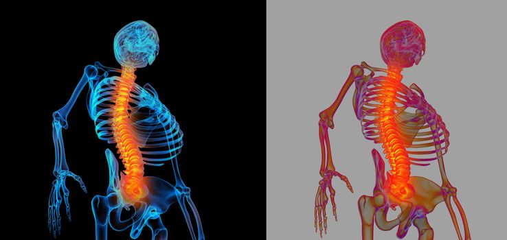 3D rendering human of painful spine