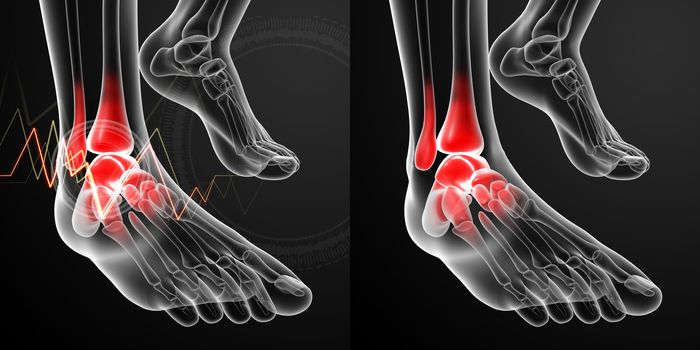 3D rendering illustration of the Ankle pain