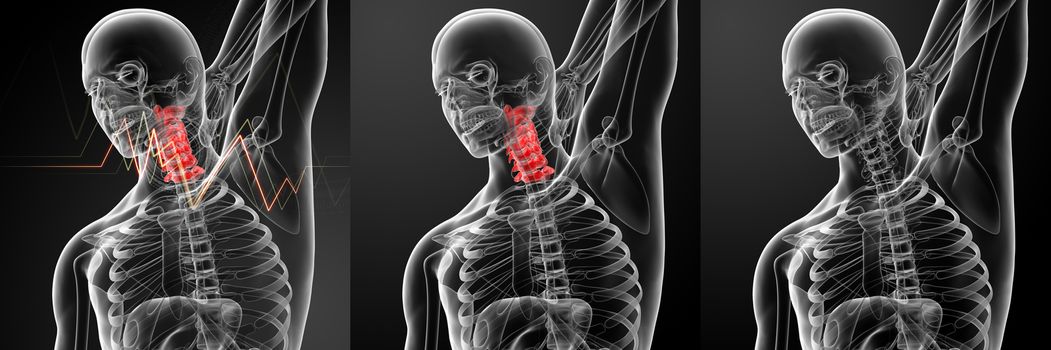 3d rendering illustration - pain neck
