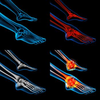3D rendering human foot pain with the anatomy of a skeleton foot