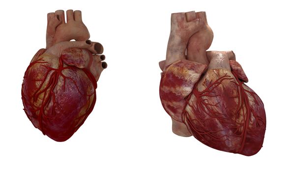 3d rendered medical illustration of a human heart