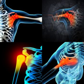 3D rendering human shoulder pain with the anatomy of a skeleton shoulder