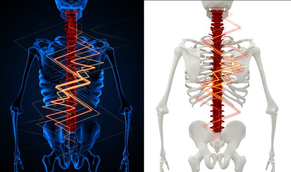 3d rendering skeleton of the man with the backache