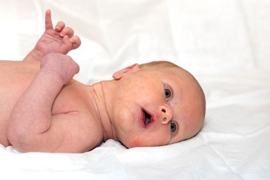 Close up shot of boy newborn jaundice lying on white bed sheet