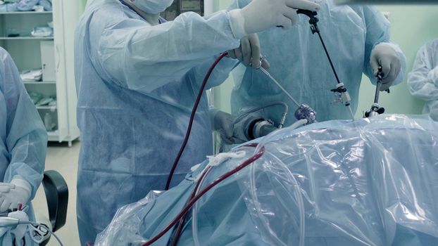 Laparoscopic surgery of the abdomen. The team of medical specialists conducting laparoscopic surgery.