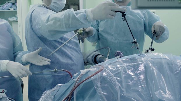 Laparoscopic surgery of the abdomen. The team of medical specialists conducting laparoscopic surgery.