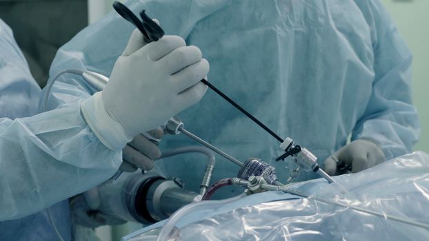 Laparoscopic surgery of the abdomen. The team of medical specialists conducting laparoscopic surgery.