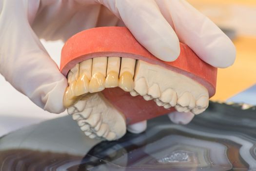 Dentures, prosthesis and oral hygiene. Hands with gloves while working on a dental prosthesis.