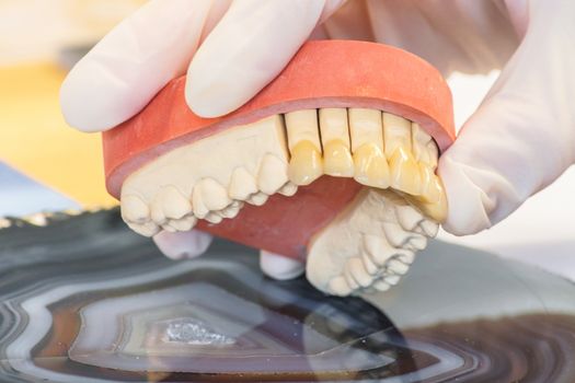 Dentures, prosthesis and oral hygiene. Hands with gloves while working on a dental prosthesis.