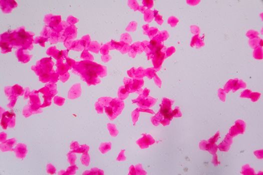 Multiple squamous epithelium under the microscope - Abstract pink dots on white background.