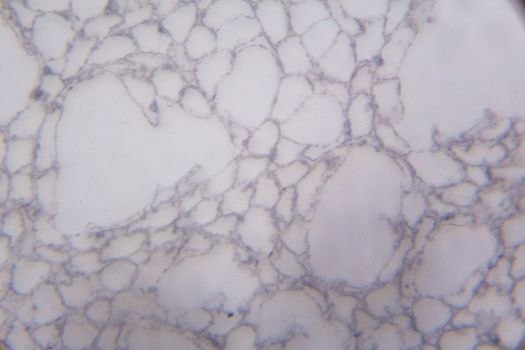 Agaricus section under the microscope.