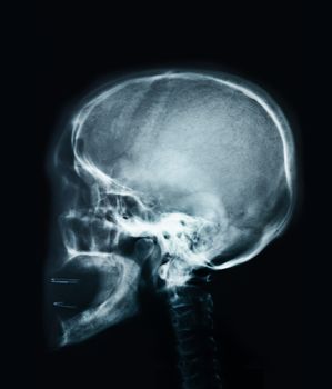 Human skull X-ray image