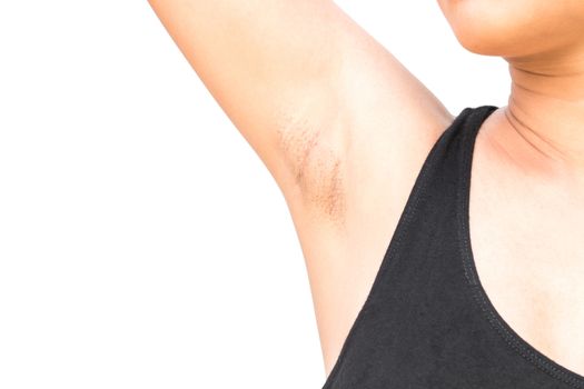 Women problem black armpit on white background for skin care and beauty concept