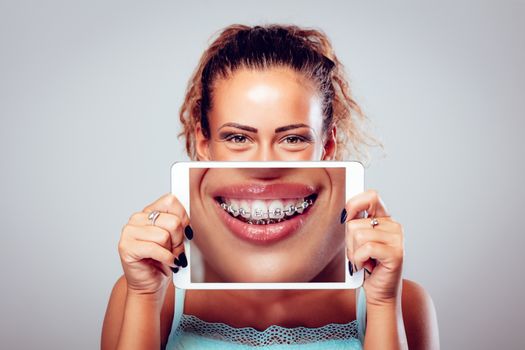 Smiling girl with braces on teeth behind digital tablet. Looking at camera.