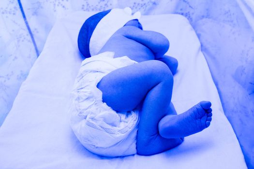 jaundice of newborns. A child under a photo lamp to treat pathological jaundice. photo for your design