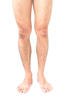 Closeup legs men skin and hairy with white background, health care and medical concept