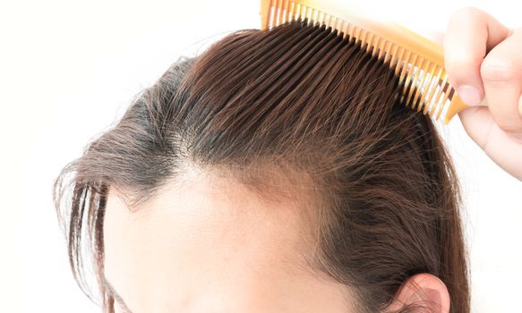 Woman serious hair loss problem for health care shampoo and beauty product concept