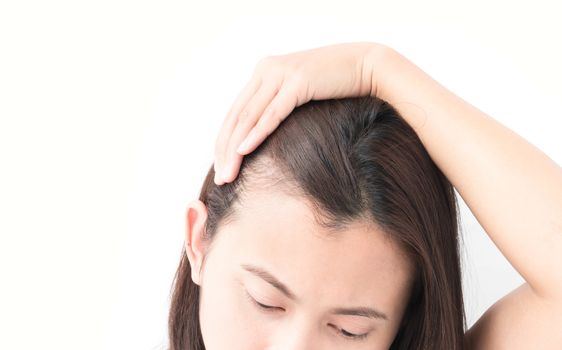 Woman serious hair loss problem for health care shampoo and beauty product concept